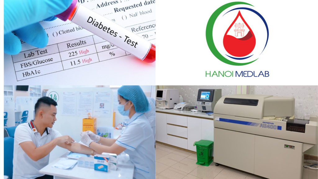 XÉT NGHIỆM ĐƯỜNG MÁU (GLUCOSE)