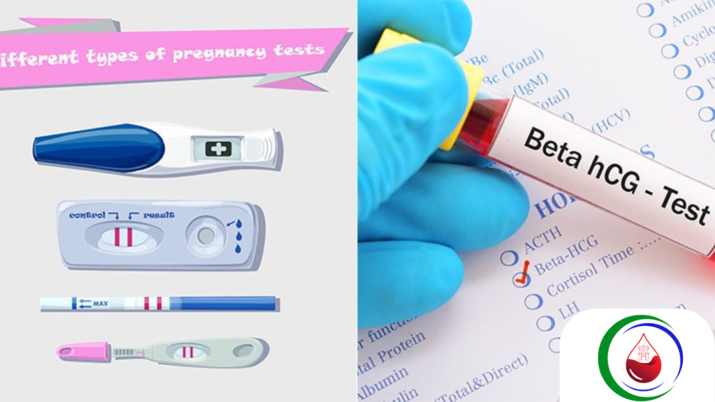Xét nghiệm gonadotropin màng đệm ở người (hCG)